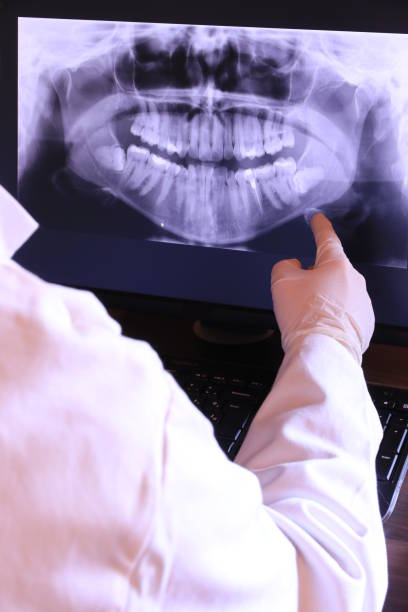 Best Emergency Treatment for Toothache in Germantown, TN
